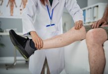 Dolor, pesadez y calambres: señales de que las várices ya no son solo un problema estético